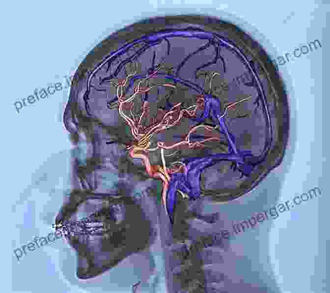 3D Visualization Of Cerebral Venous Pathology 3D Angiographic Atlas Of Neurovascular Anatomy And Pathology