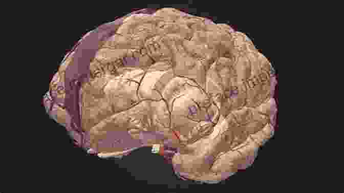 3D Visualization Of Cerebrovascular Anatomy 3D Angiographic Atlas Of Neurovascular Anatomy And Pathology