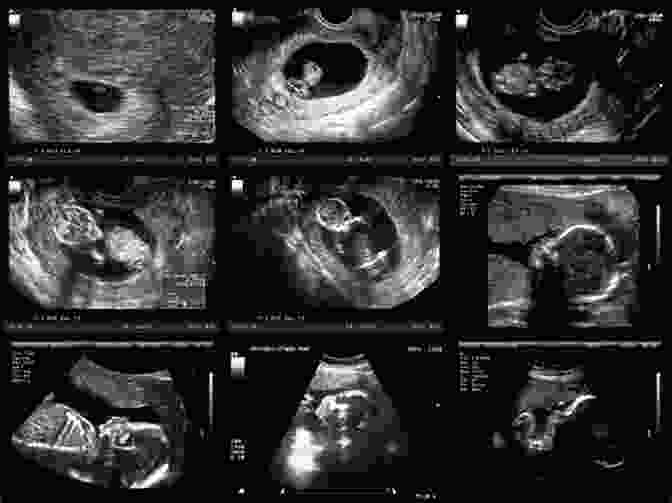 An Ultrasound Image Showing The Developing Fetus Inside A Pregnant Woman's Uterus The First Time Dad S Guide To Pregnancy: A Week By Week Strategy Guide For The Next 9 Months Including Checklists Tips And Pregnancy Hacks For First Time Dads