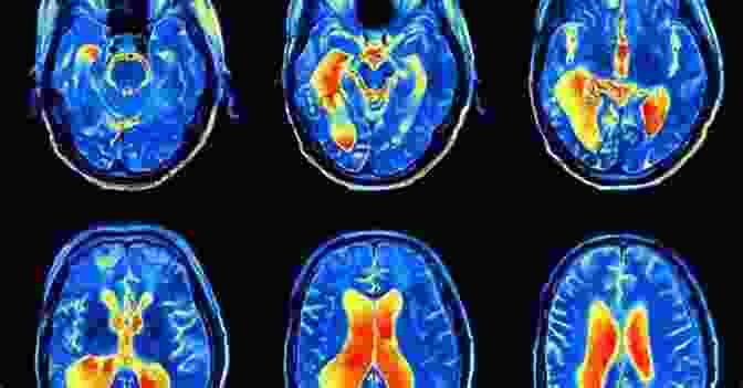 Example Of An MRI Scan Of The Brain, Showing The Brain Tissue, Ventricles, And Other Structures. Medical Imaging Of Normal And Pathologic Anatomy