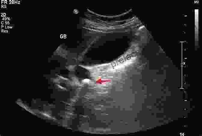 Example Of An Ultrasound Scan Of The Abdomen, Showing The Liver, Gallbladder, And Other Structures. Medical Imaging Of Normal And Pathologic Anatomy