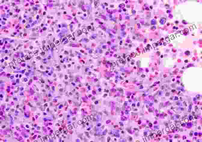 Mast Cell In Tissue The Mast Cell: A Multifunctional Effector Cell