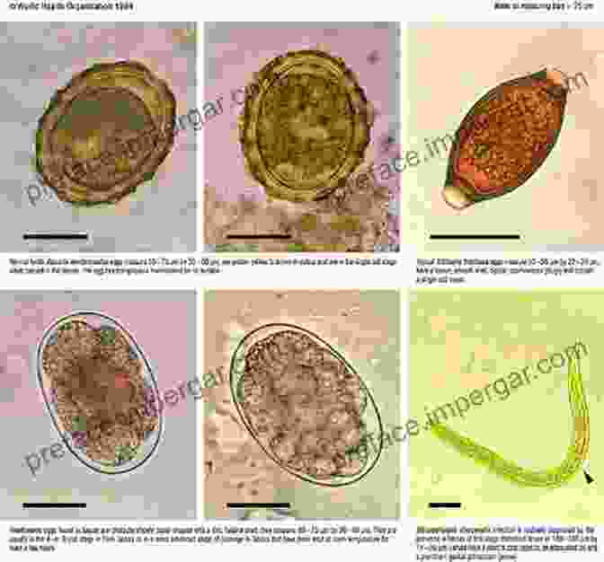 Microscope Image Of A Parasite Medical Parasitology: A Self Instructional Text