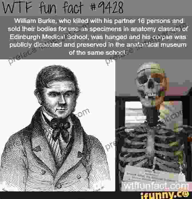 William Burke's Body Being Publicly Dissected After His Execution. His Murder With William Hare Sparked Public Outrage And Led To Reforms In Anatomical Research. The History Of Burke And Hare And Of The Resurrectionist Times