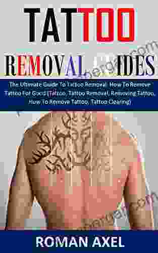 TATTOO REMOVAL GUIDE: The Ultimate Guide To Tattoo Removal: How To Remove Tattoo For Good (Tattoo Tattoo Removal Removing Tattoo How To Remove Tattoo Tattoo Clearing)