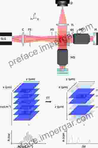 Swept Source Optical Coherence Tomography: A Color Atlas