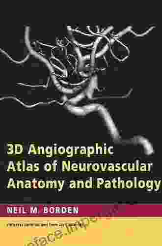 3D Angiographic Atlas Of Neurovascular Anatomy And Pathology