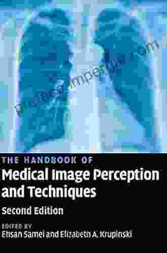 The Handbook of Medical Image Perception and Techniques